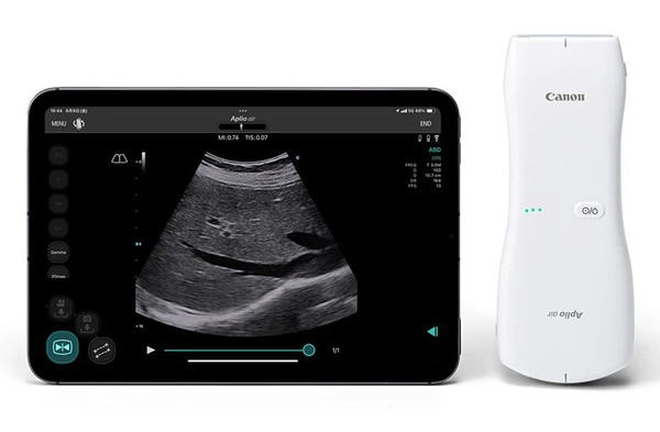 当院が導入しているエコー（超音波画像診断機）本体とワイヤレスプローブ